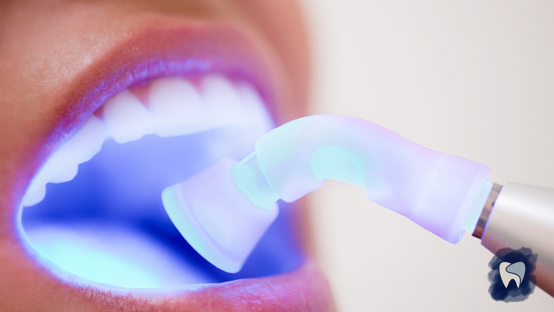 Dental procedure with blue light on open mouth.