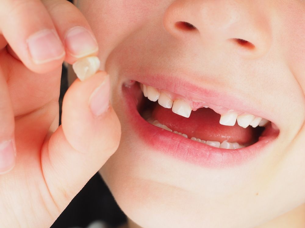 Child holding a recently lost tooth, mouth open, showing gap and other teeth.