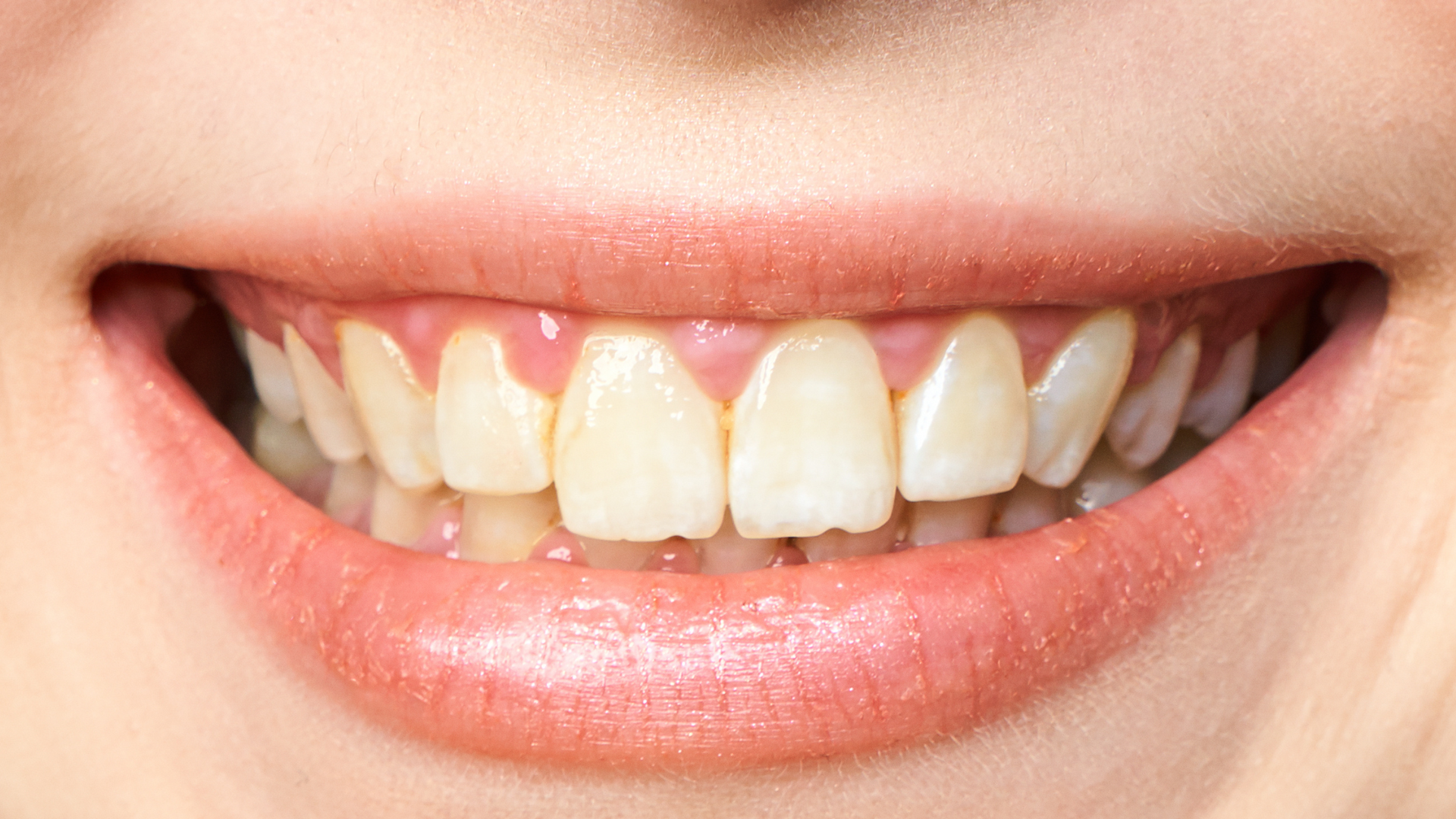 Close-up of a smiling mouth with slightly yellowed teeth and pink lips.