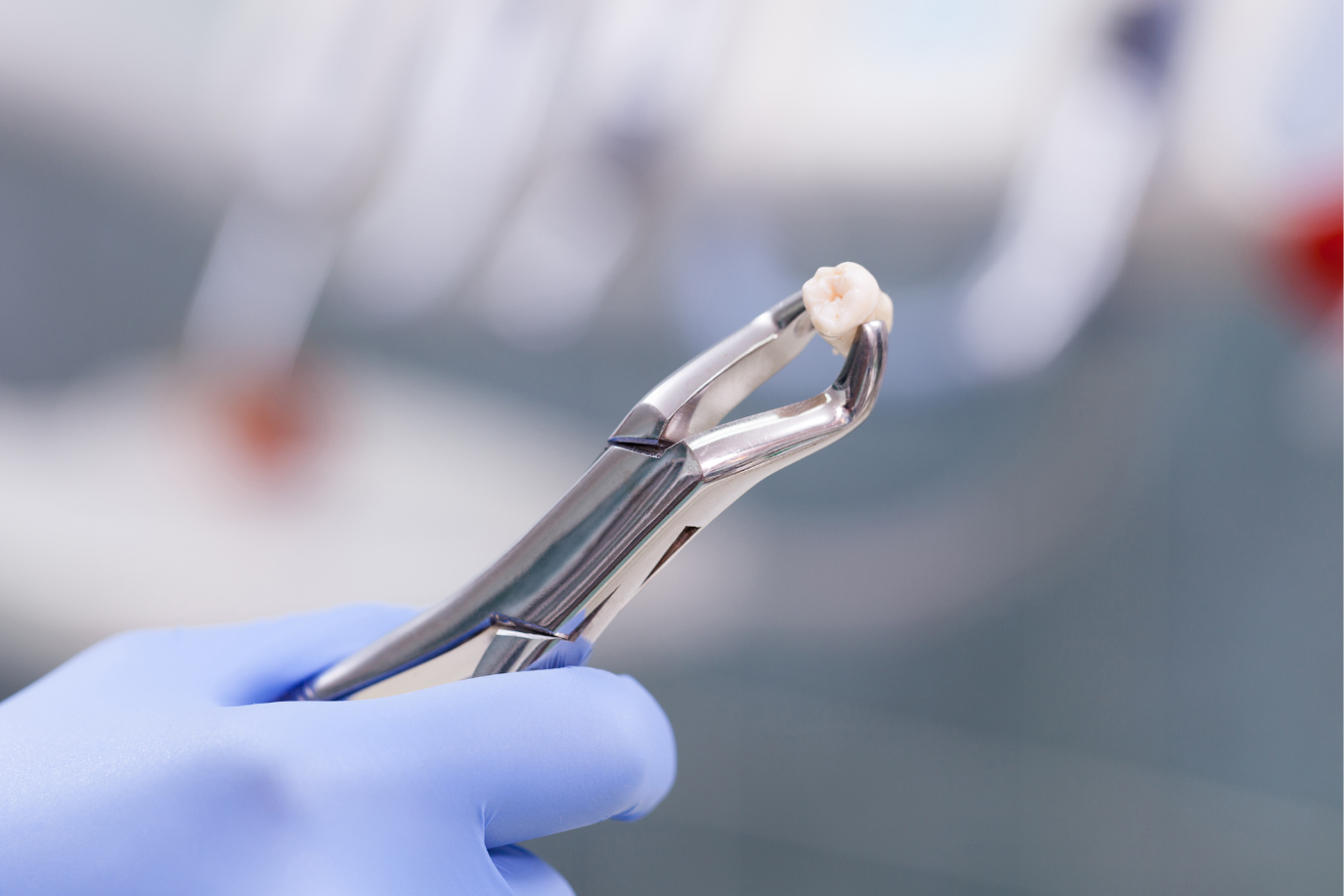 A gloved hand holds dental forceps with a removed tooth in a blurred medical setting.