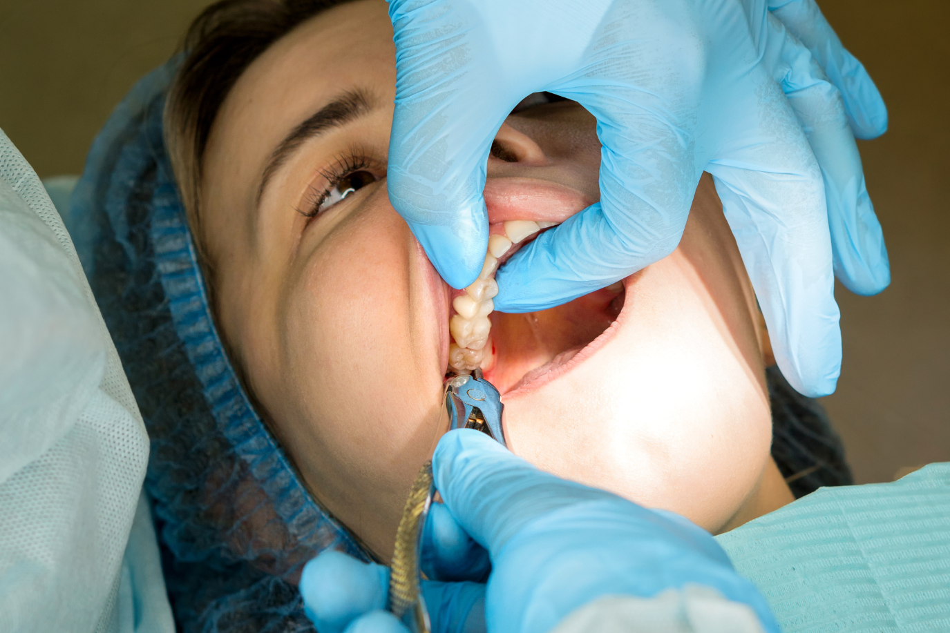 Dentist extracting a tooth from a woman's mouth; gloved hands, dental tools, patient in dental chair.