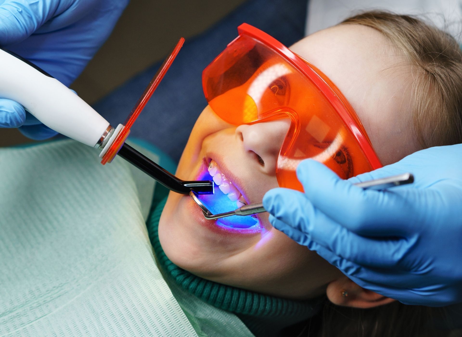 Dentist uses blue light on patient's tooth. Patient wears orange safety glasses and has mouth open.