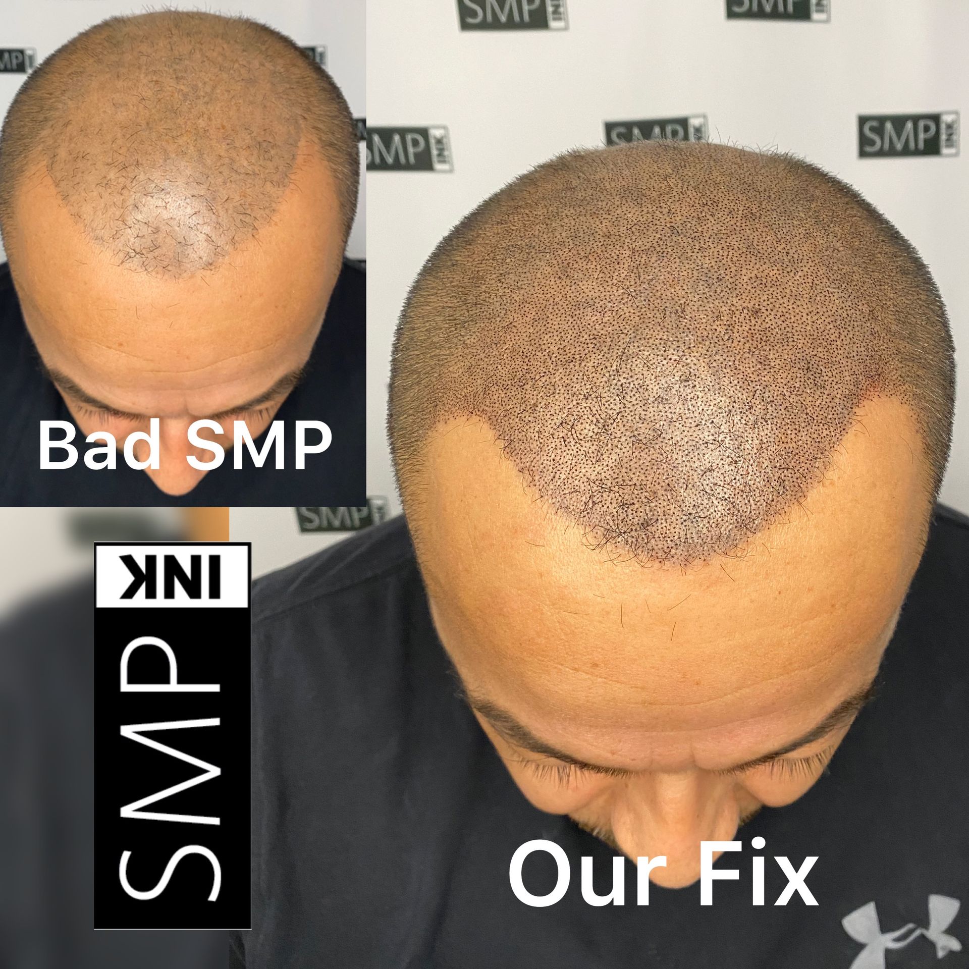 Before and after example of SMP Touch ups