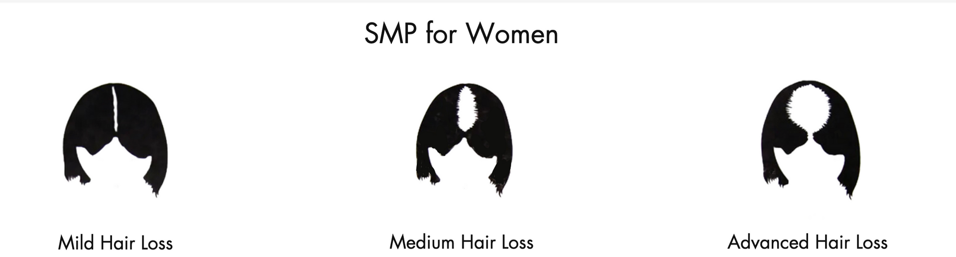 Three different types of hair loss for women are shown on a white background