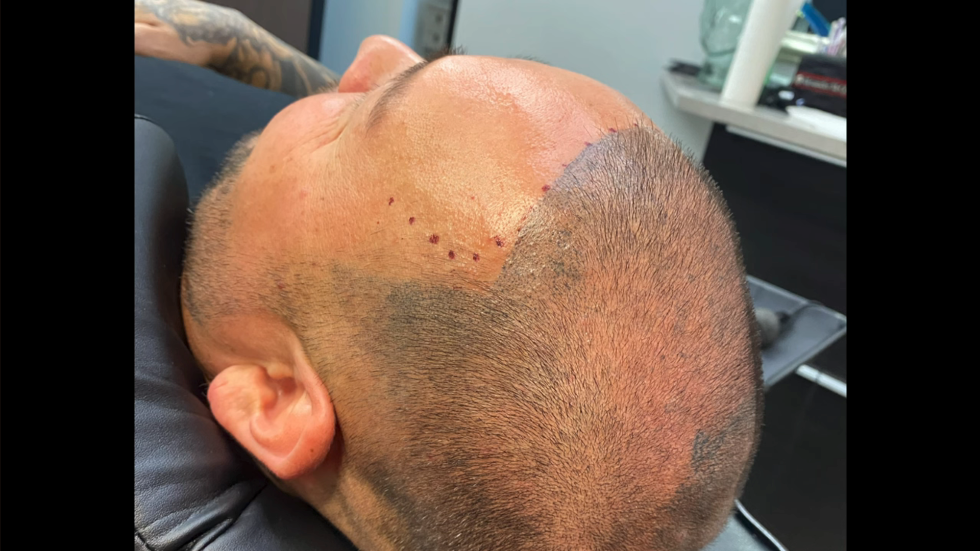 A close up of a man 's head with a tattoo on it.