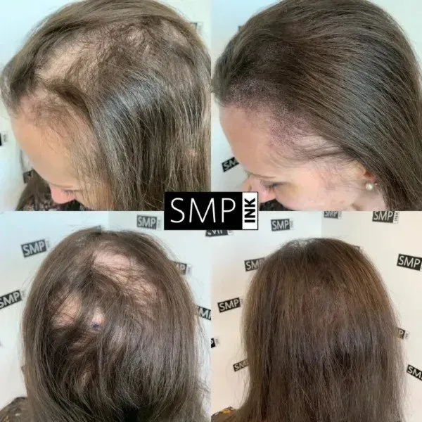 before and after receiving SMP from SMP INK