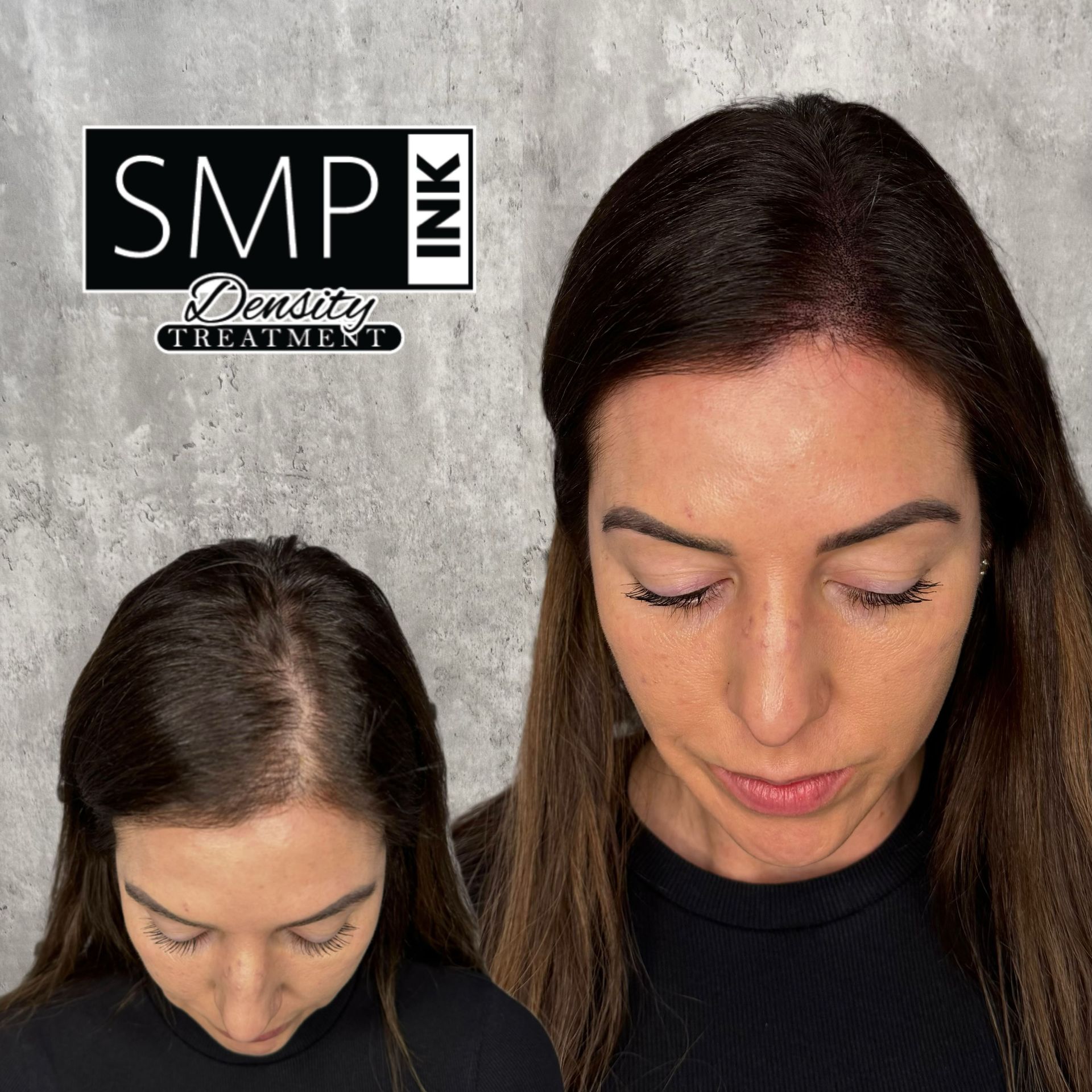calp micropigmentation density fill example by SMP INK CDA