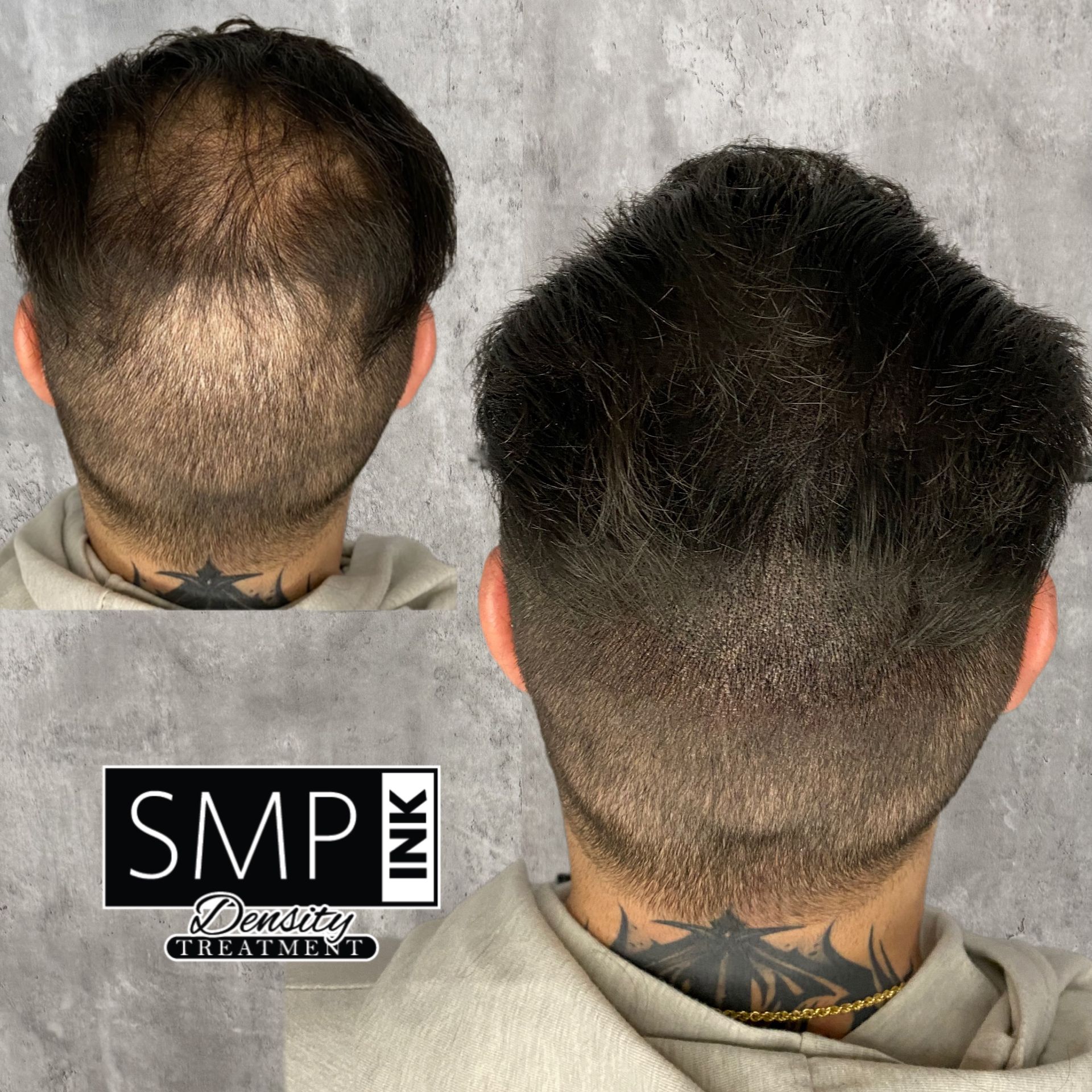 SMP Density Fill Result