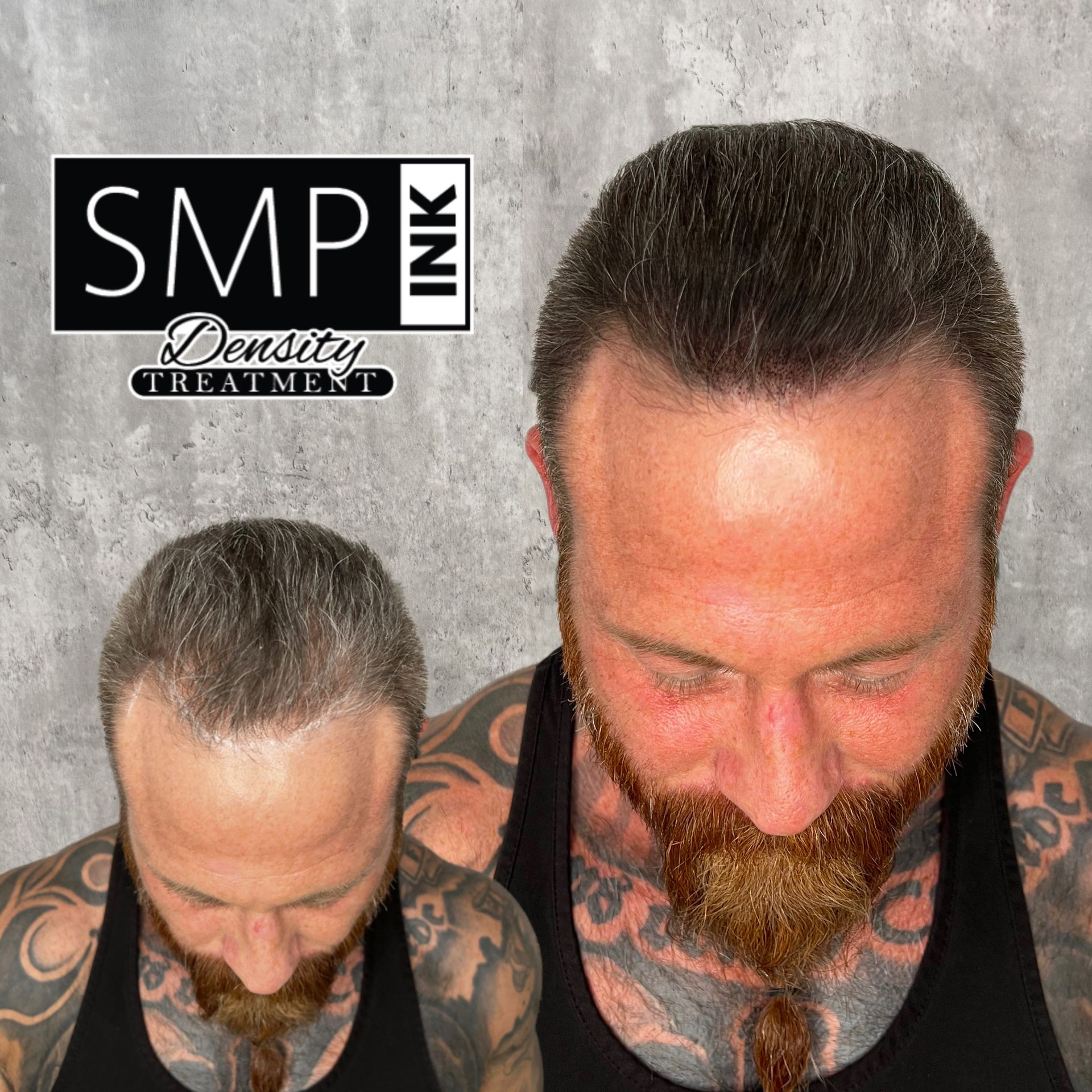 Picture of clients SMP Density Fill Result