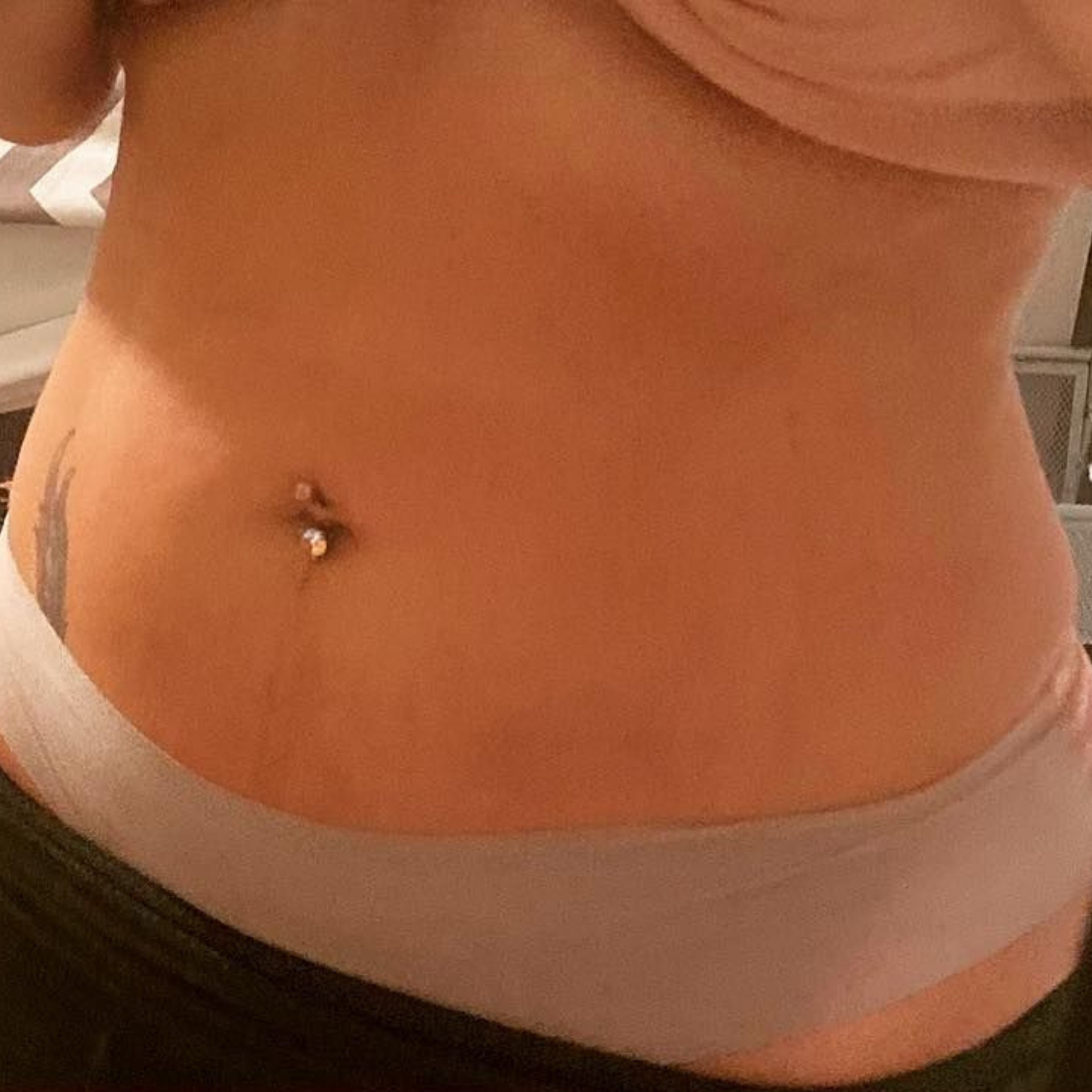 Before Weight Loss Injections