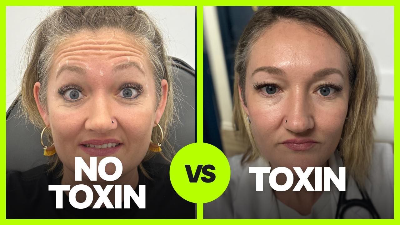 Split-screen comparison of two faces with captions “NO TOXIN” and “TOXIN” and a green “VS” circle between them