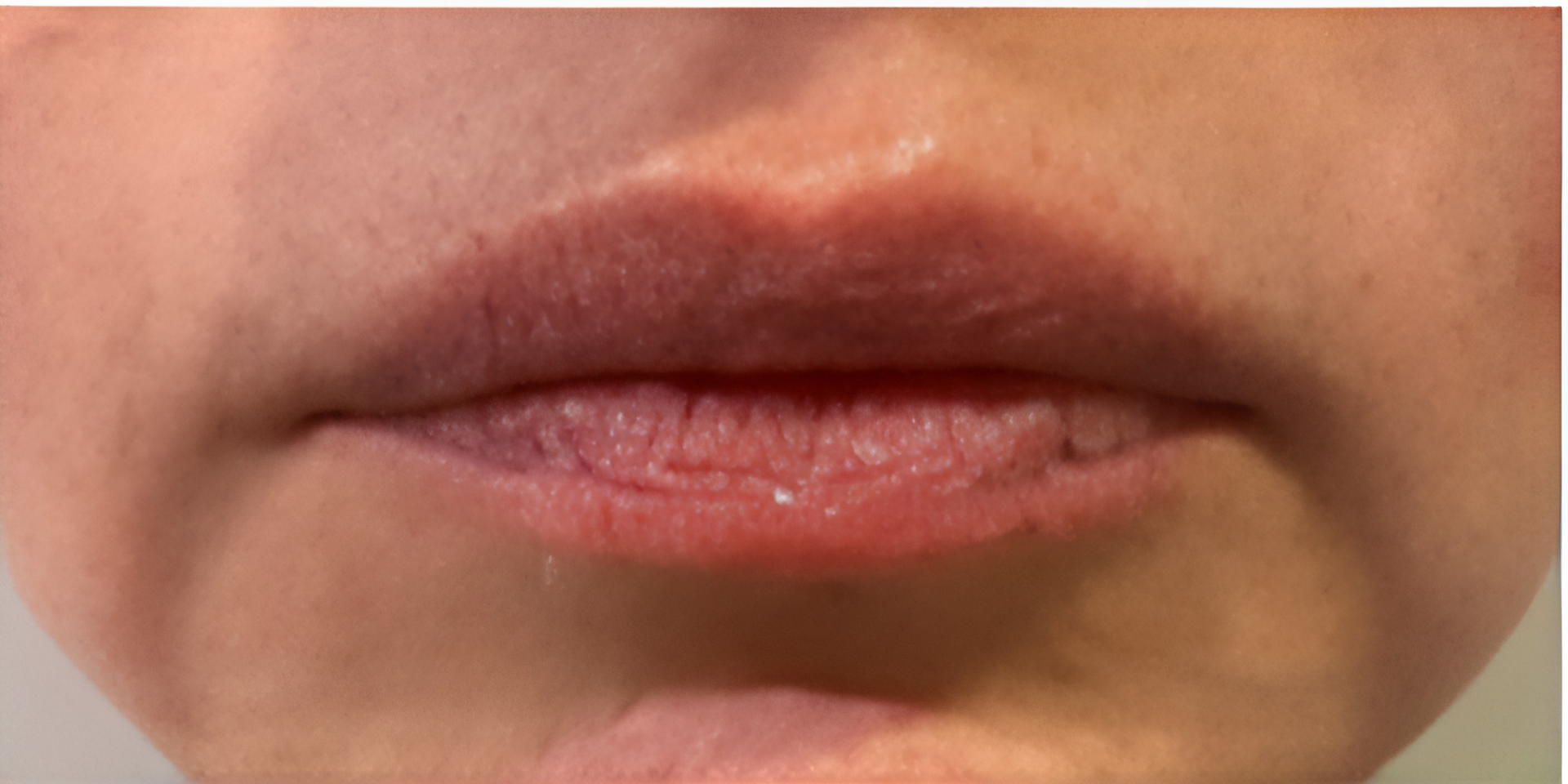 Before Peptide Therapy