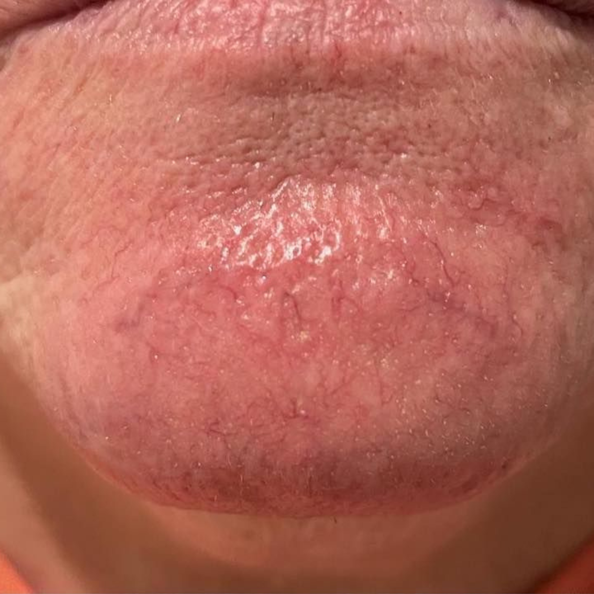 Before Peptide Therapy