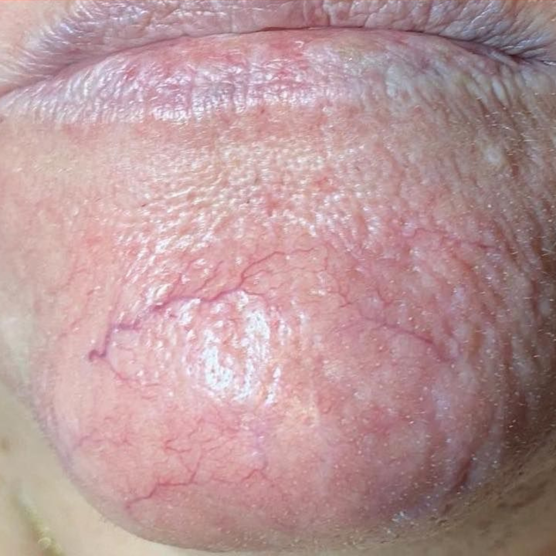 After Peptide Therapy