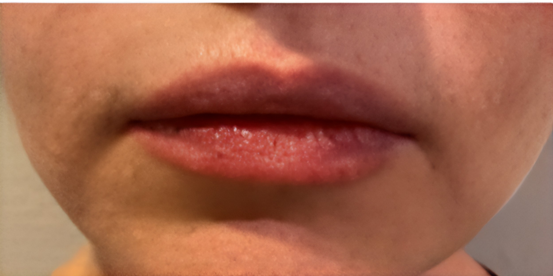 After Peptide Therapy