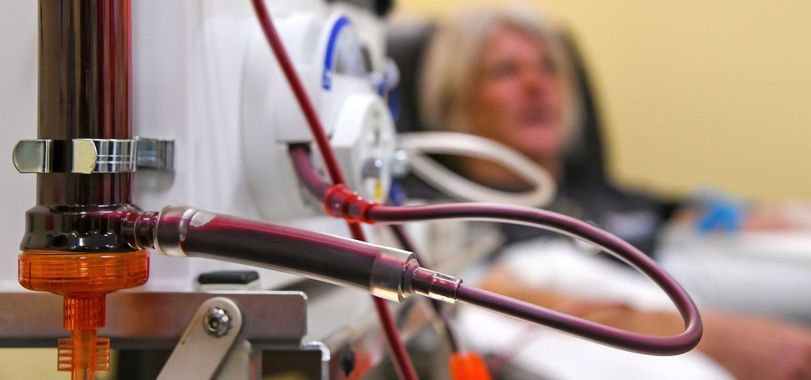 A dialysis machine connected to a person, with red tubes visible, likely a medical setting.