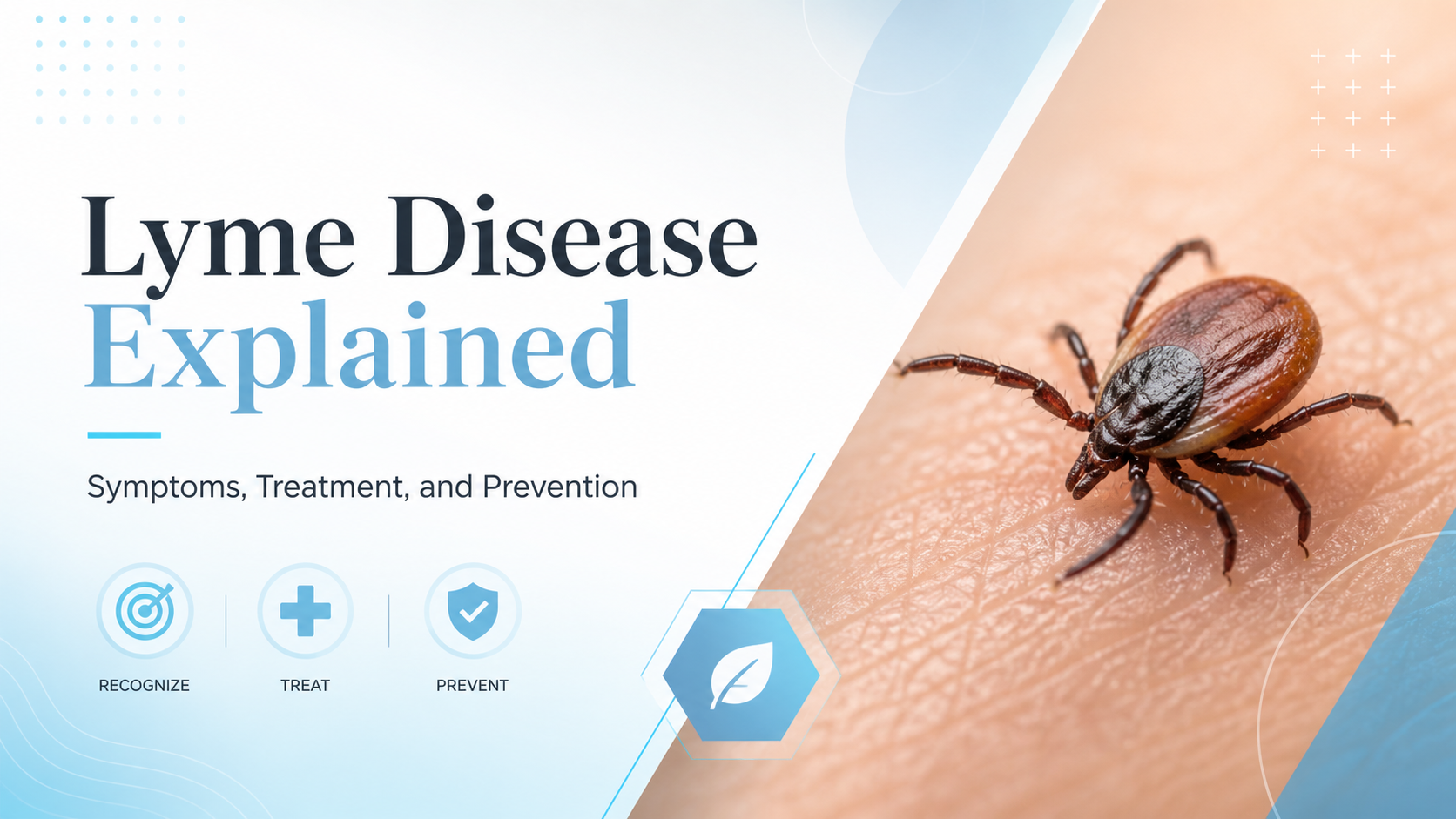 Comprehensive overview of recognizing, treating, and preventing Lyme disease.