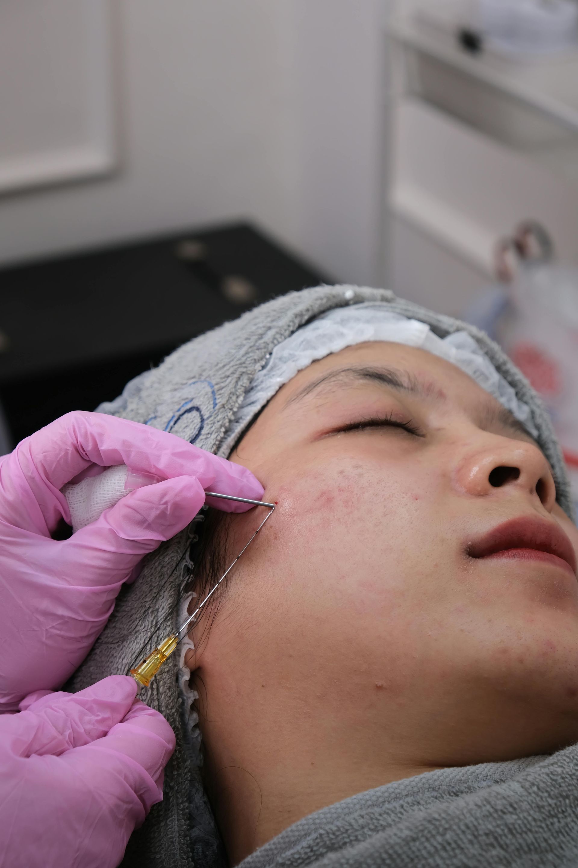 Person receiving cosmetic treatment, needle near cheek, pink-gloved hands, spa setting.