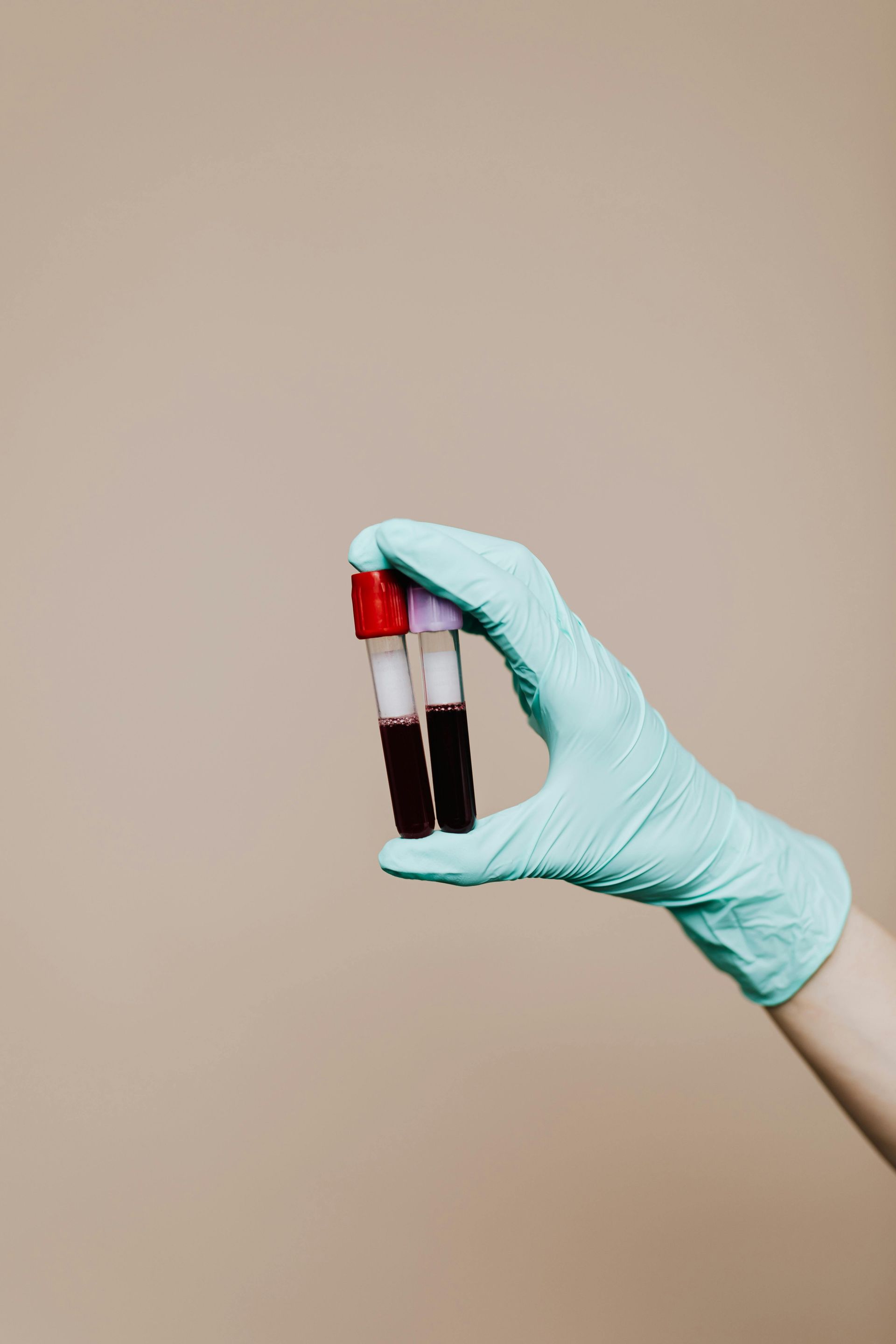 Gloved hand holding two blood sample tubes. Tubes have red and purple tops, and contain dark liquid.