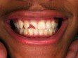Before - General Dentist in Riverdale, MD