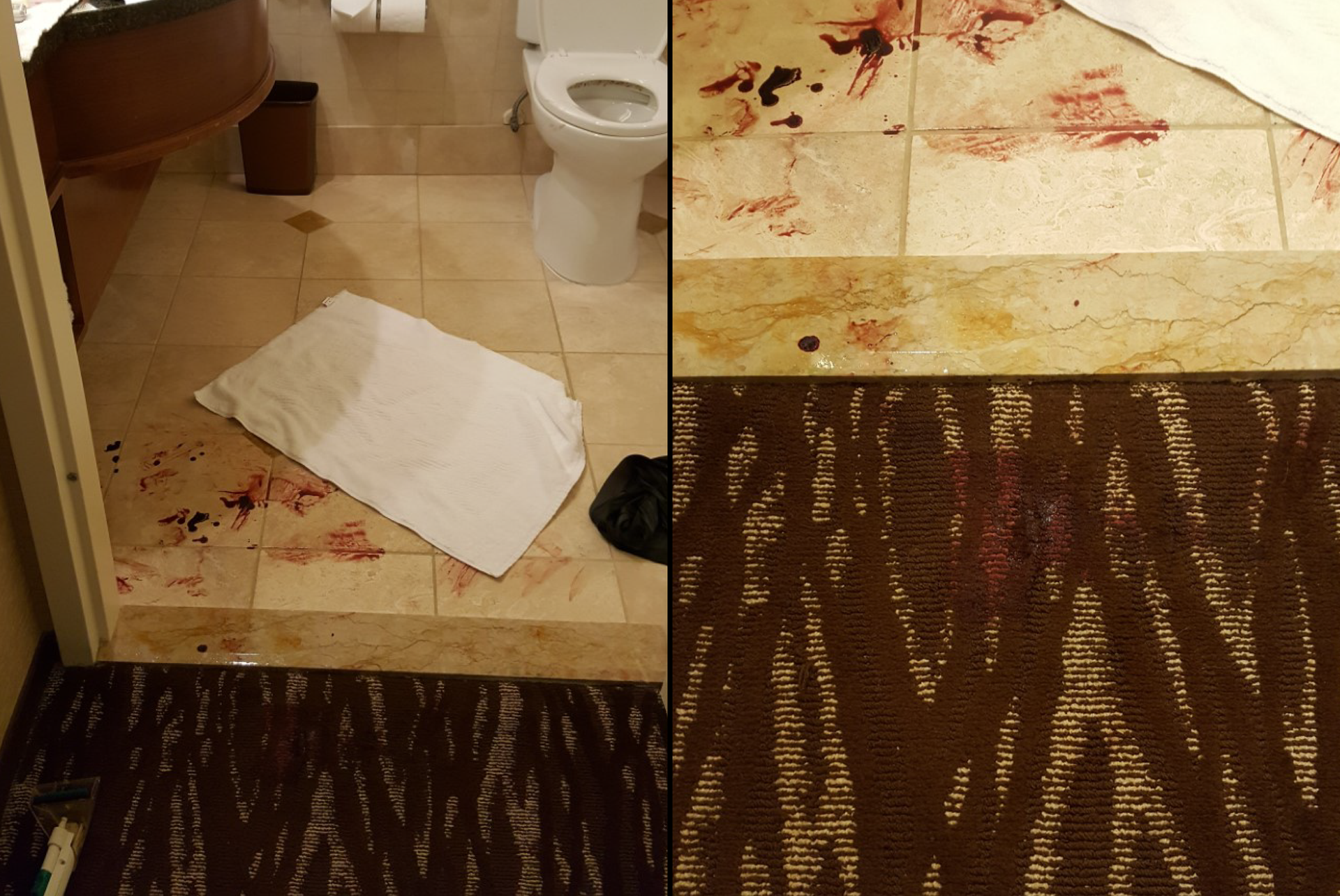 blood stain removal