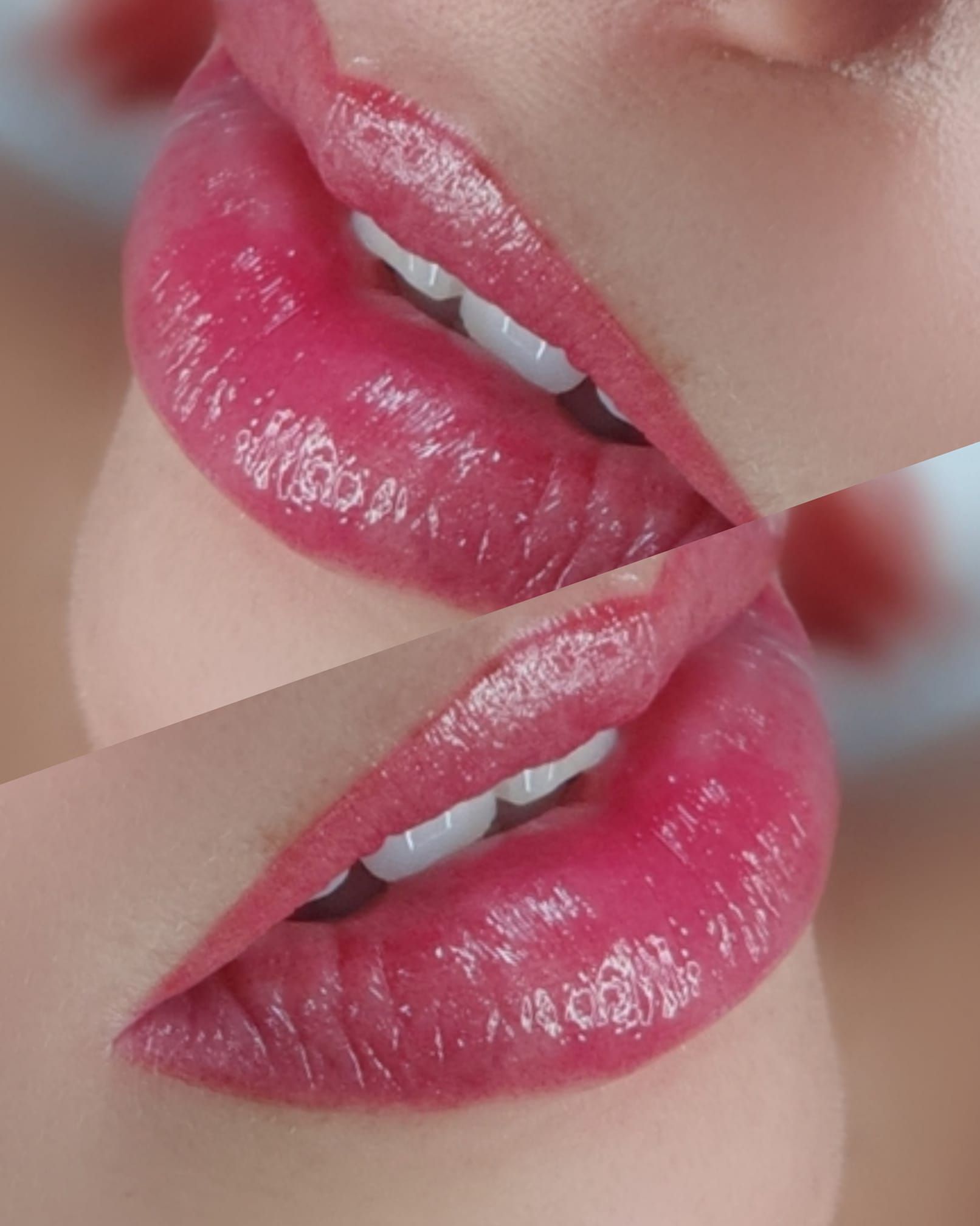 Two Sets of Glossy, Pink Lips Partially Visible — Artisan Cosmetic Tattoo & Beauty in Worongary, QLD