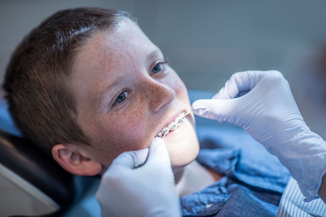 Apparecchio dentale