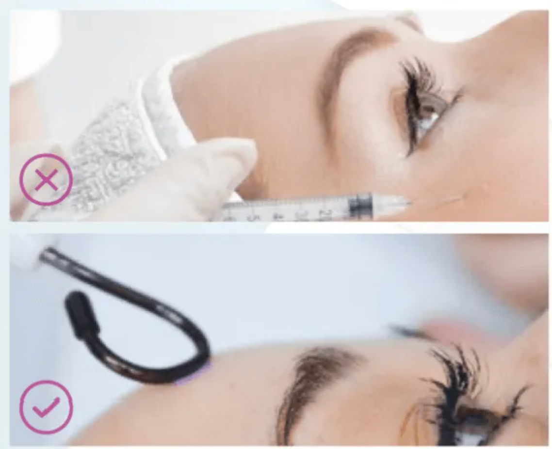 Eine Frau bekommt eine Botox-Injektion ins Auge