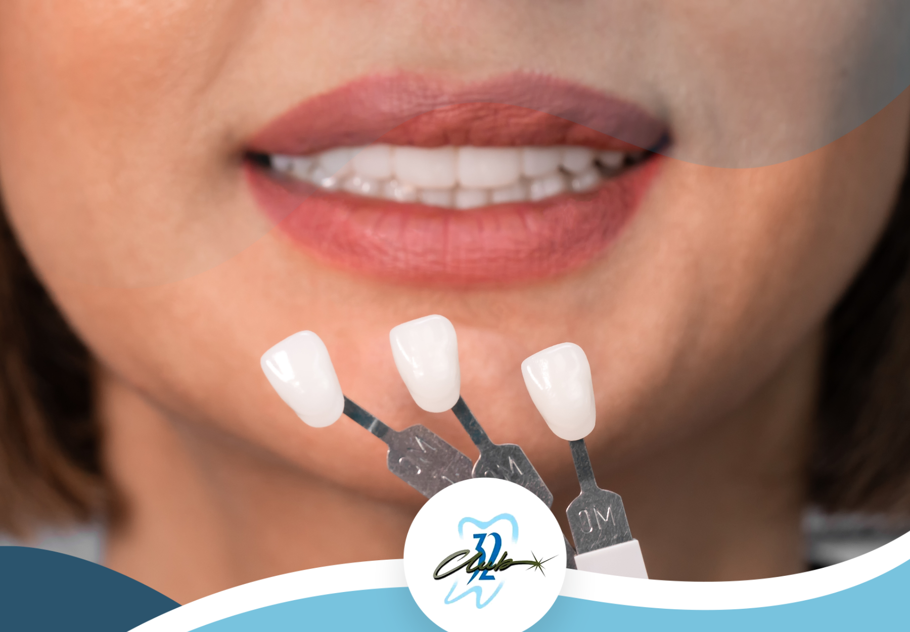 A close up of a woman 's mouth with three shades of white teeth.