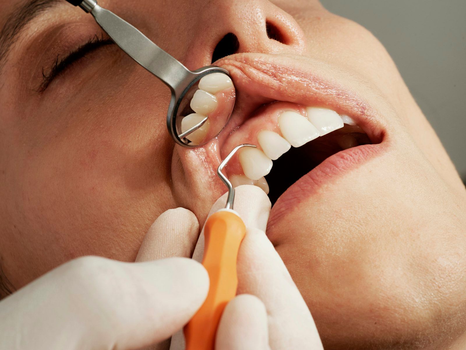 Dentist using a dental tool and mirror to examine a patient’s open mouth