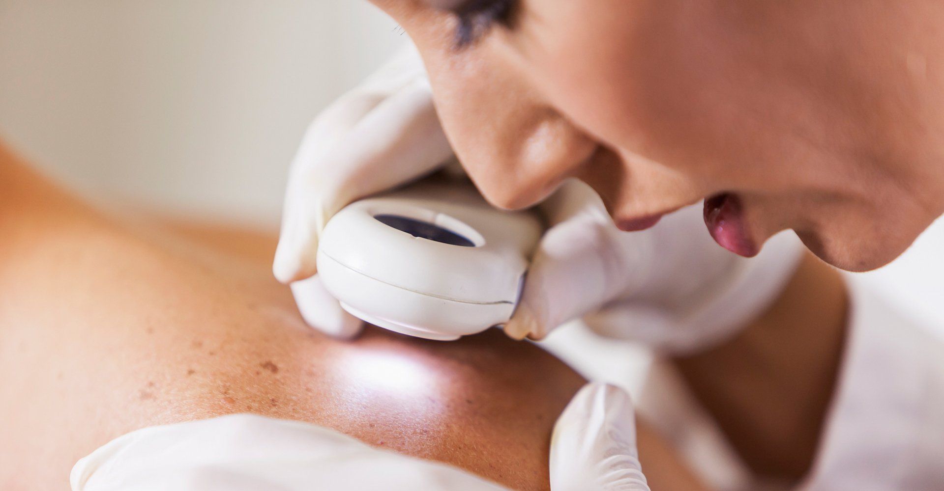 Checking Of Skin — Davenport, IA — William Colantoni Jr MD PC