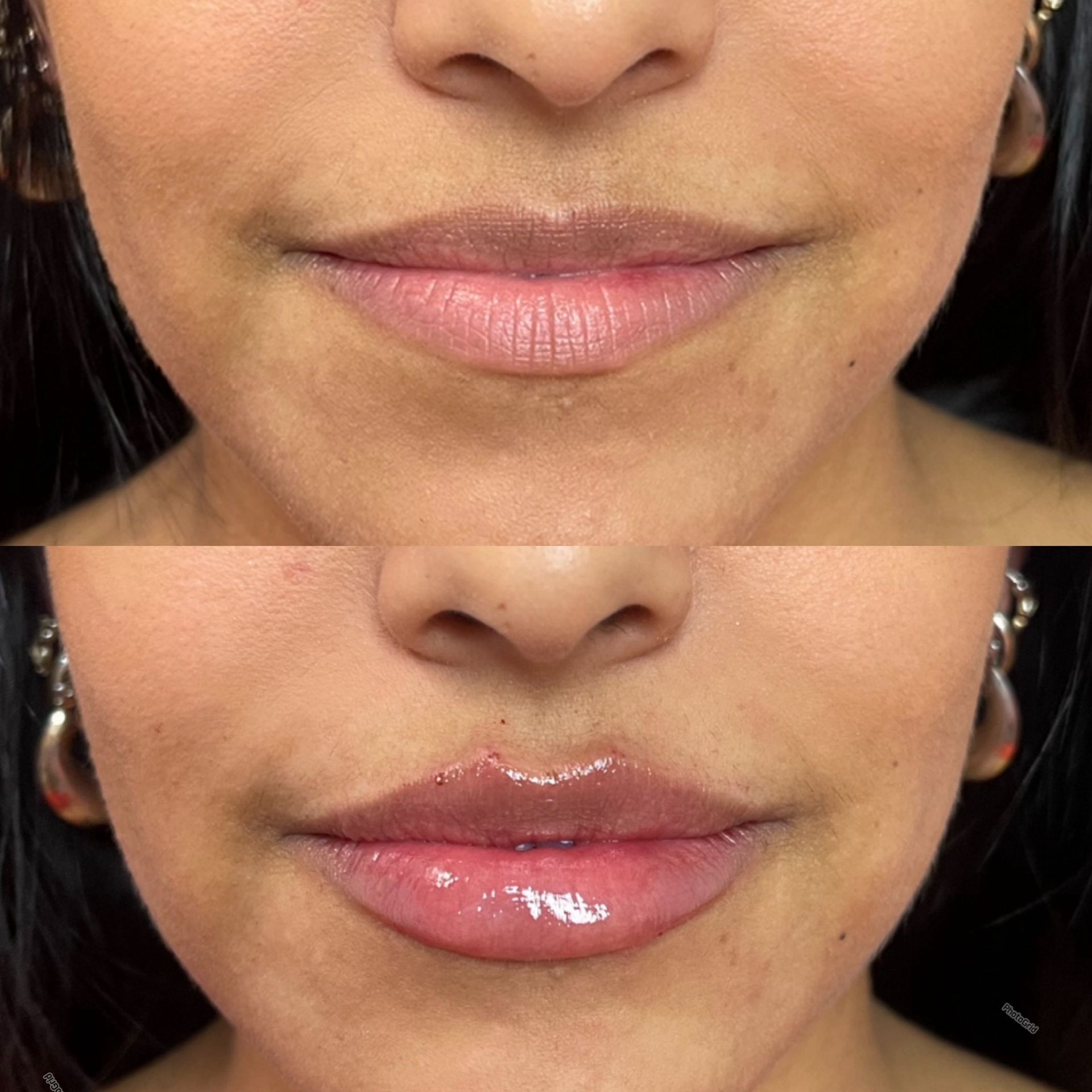 Before-and-after of lips: top lip appears thinner; bottom lip fuller and glossier.