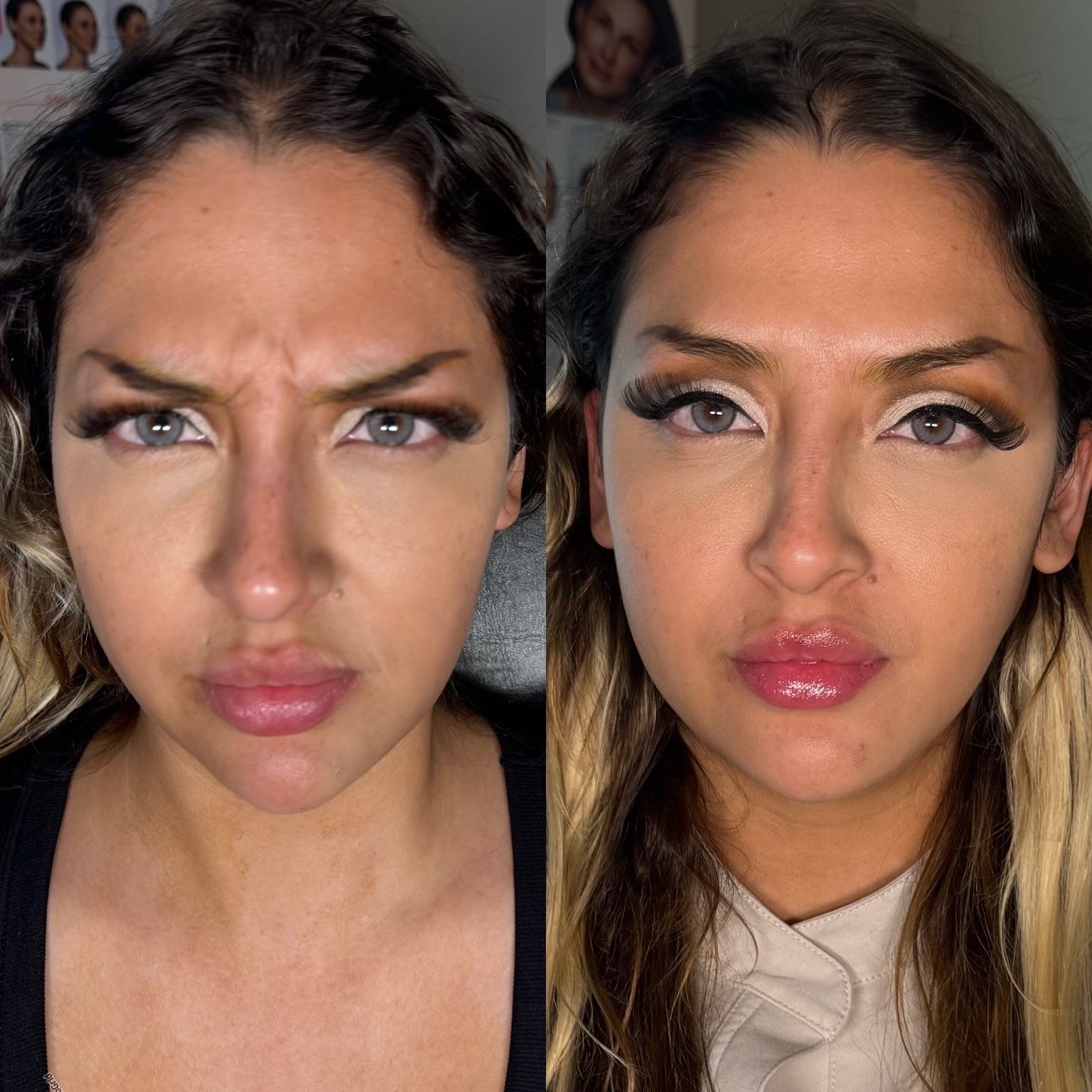 Side-by-side comparison of a woman's face before and after cosmetic procedures. Expressionless face; different makeup.