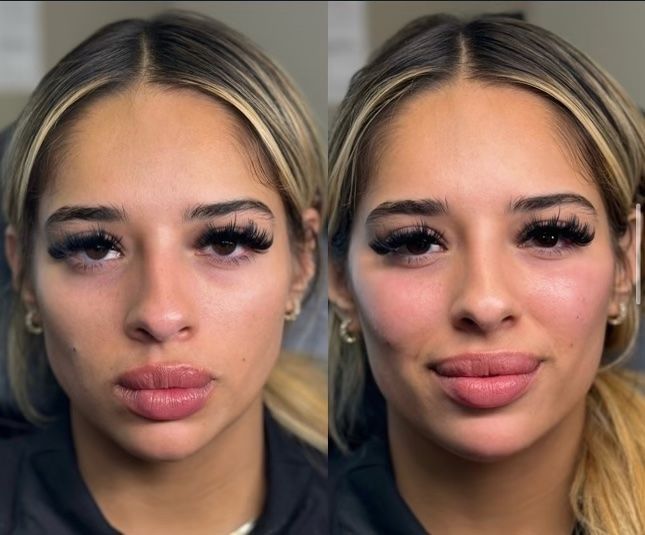 Side-by-side before-and-after photos of a woman's face. Changes include fuller lips and cheeks, darker lashes.