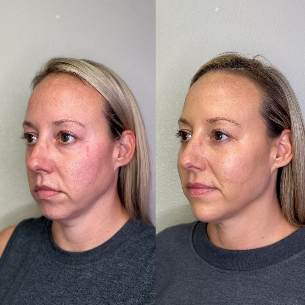 Side-by-side portraits show a woman before (left) and after (right) facial cosmetic work. She has a smoother complexion.