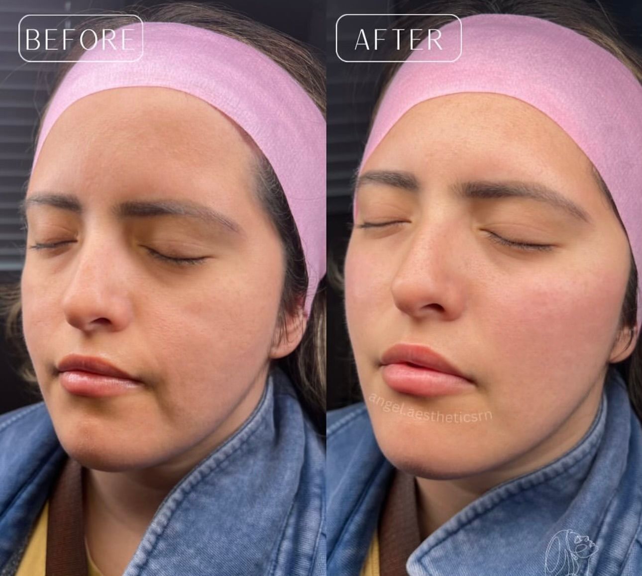 Side-by-side comparison of a woman's face; 