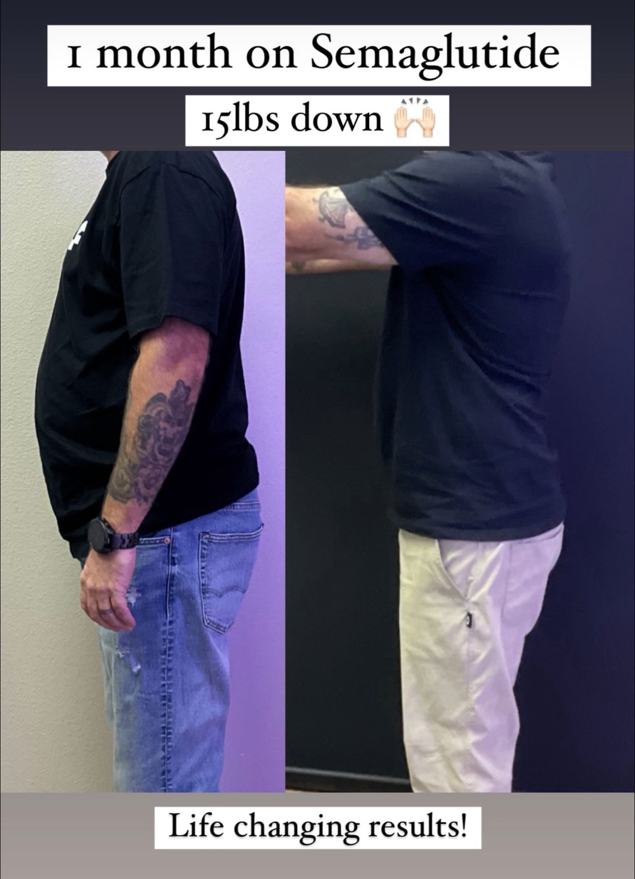 Before and after photos of a man's side profile; lost weight in one month on Semaglutide.