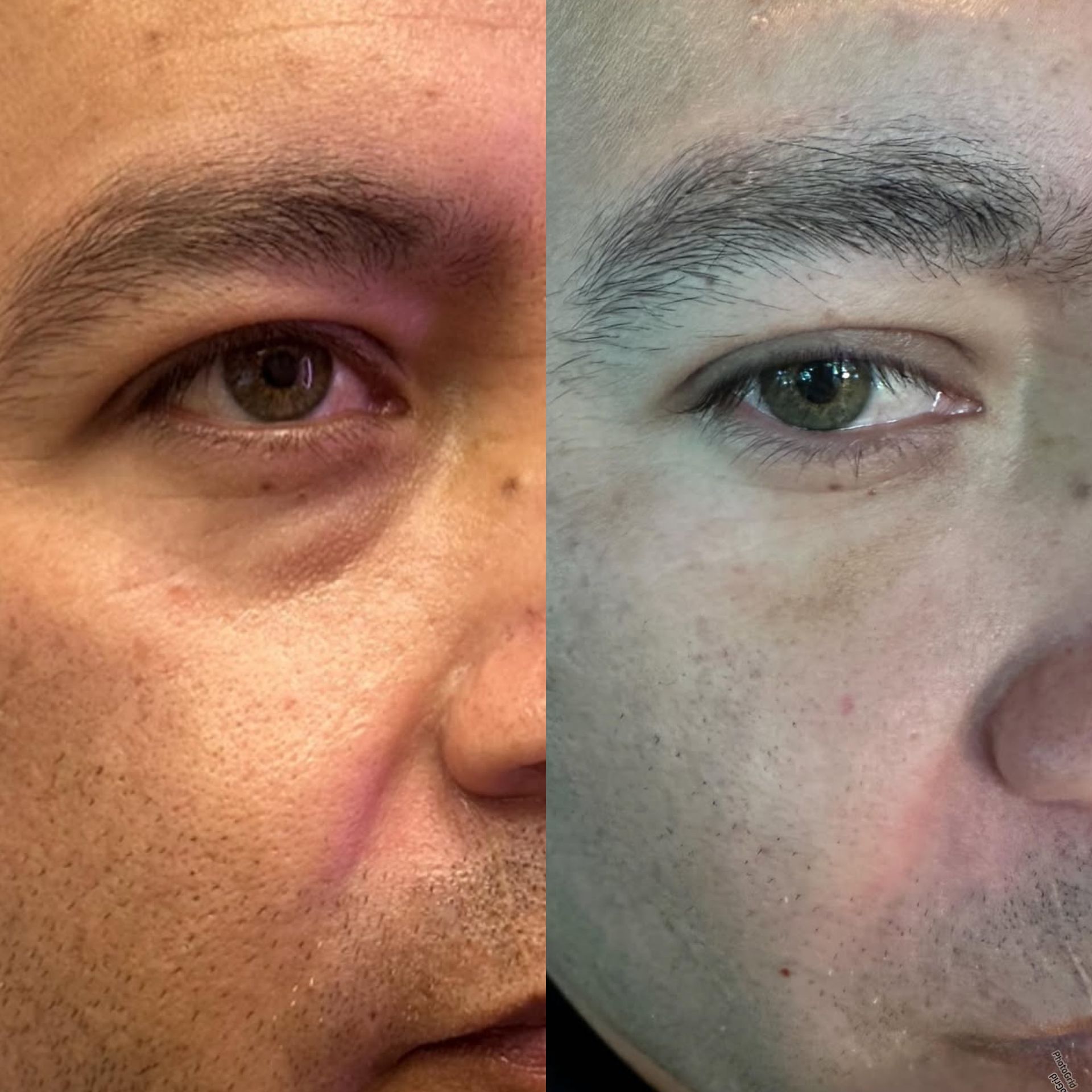 Close-up split face shows skin tone difference: darker on the left, lighter on the right; eyes appear to change color.