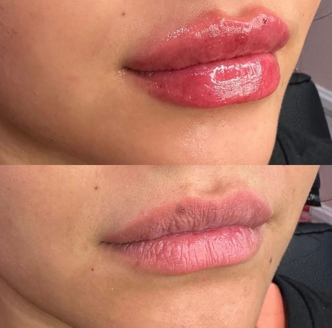 Before and after photos of a woman's lips: top image is enhanced, glossy pink; bottom image is natural.
