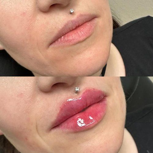 Before and after comparison: woman's lips. Top, natural; bottom, fuller and red-tinted, with lip gloss.