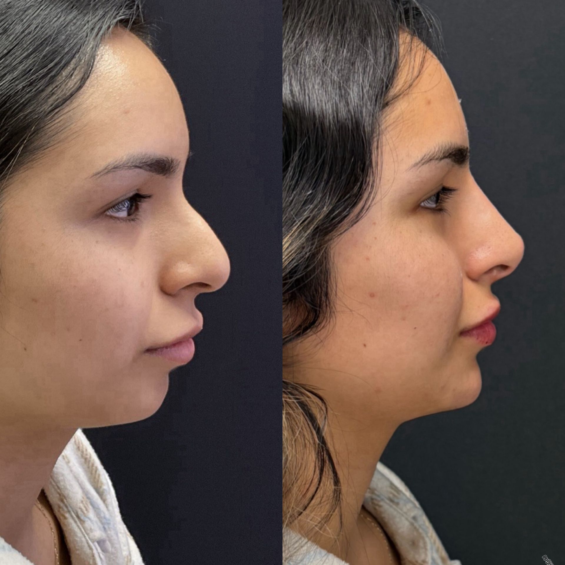 A before and after photo of a woman 's face