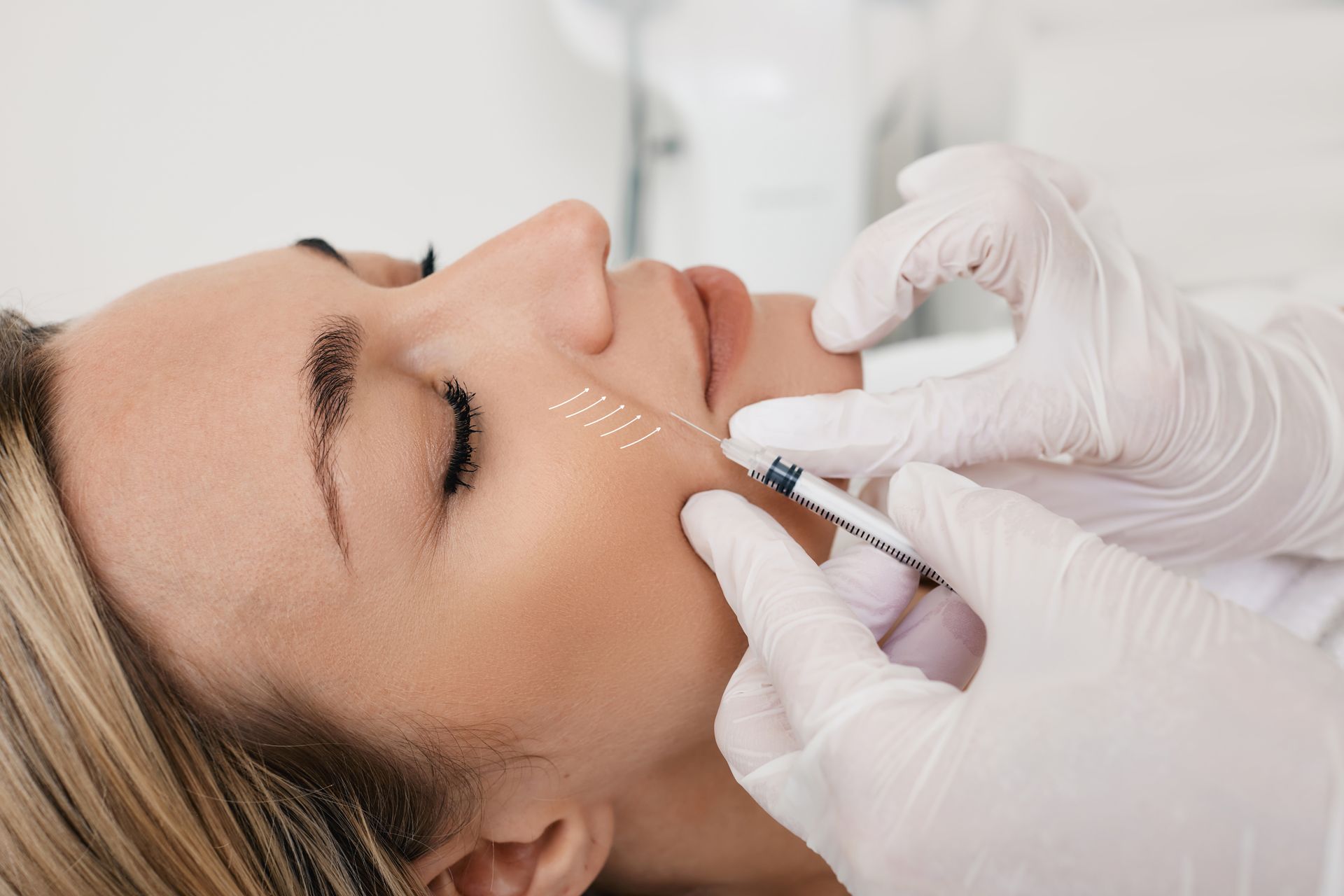 Woman receiving facial injections; gloved hands inject medication into the cheek.