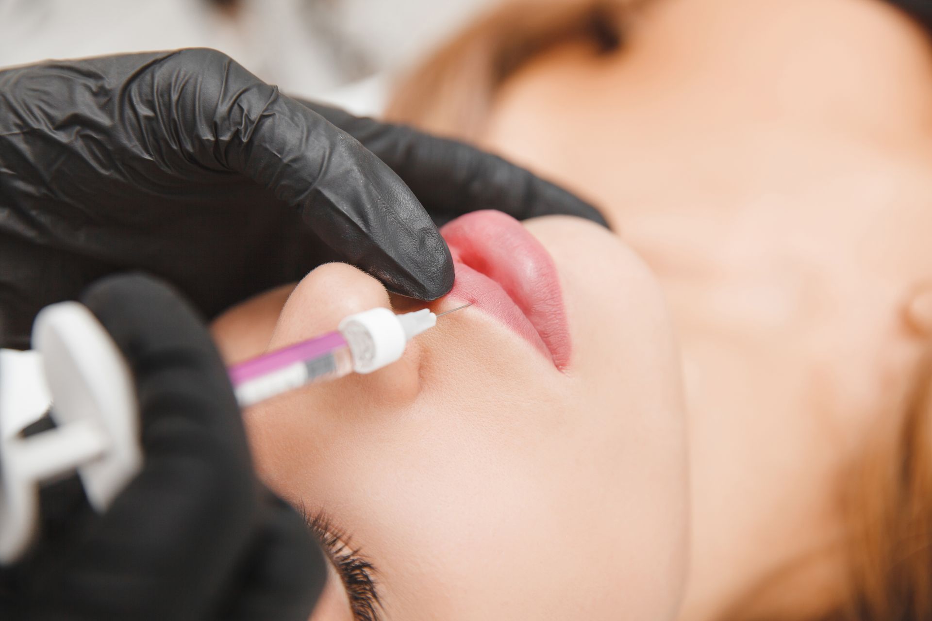 Person receiving lip filler injections, held by a person wearing black gloves.