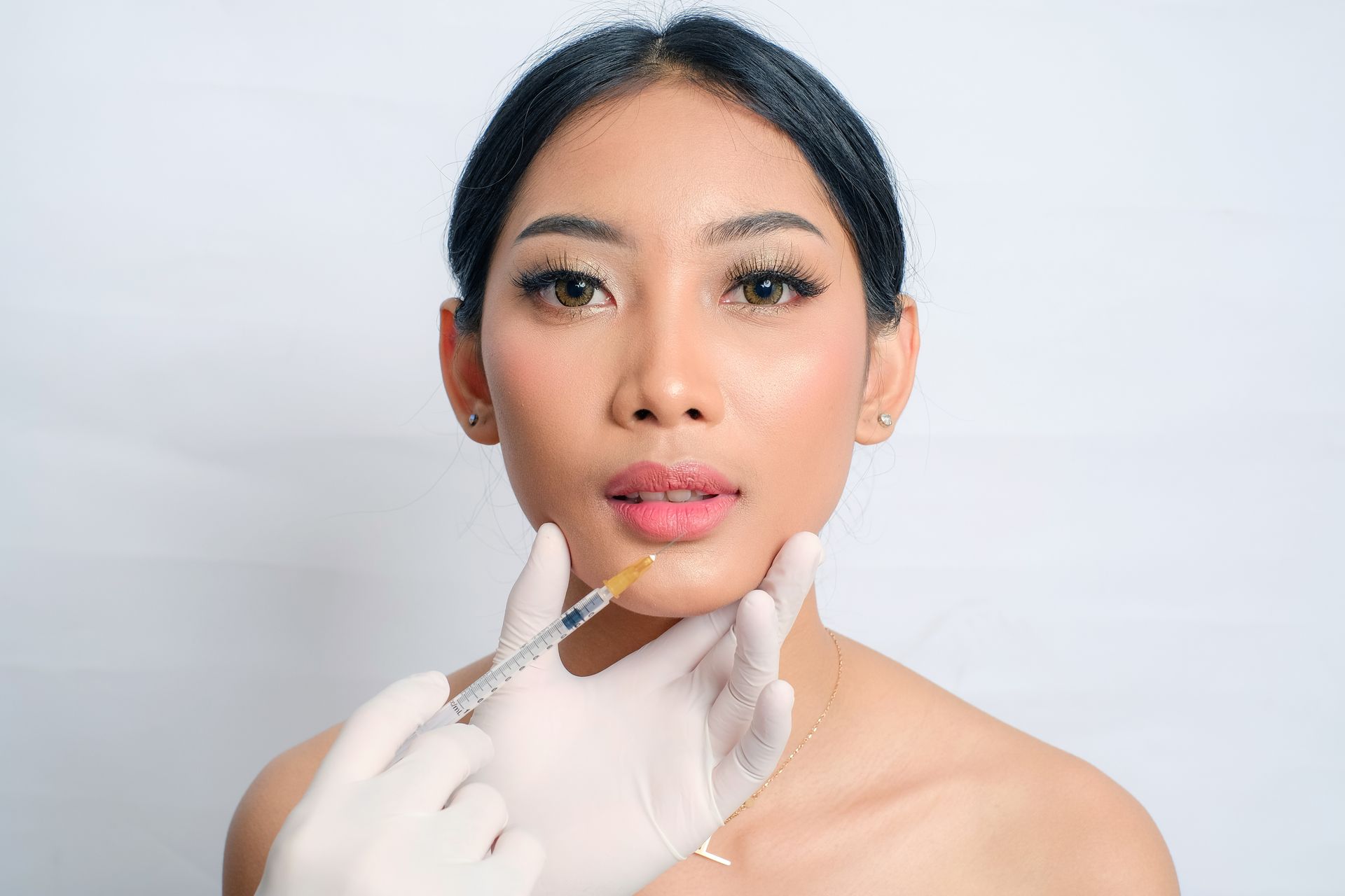 A person receiving lip injections with a syringe by someone wearing gloves.