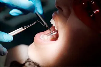 A woman is getting her teeth examined by a dentist.