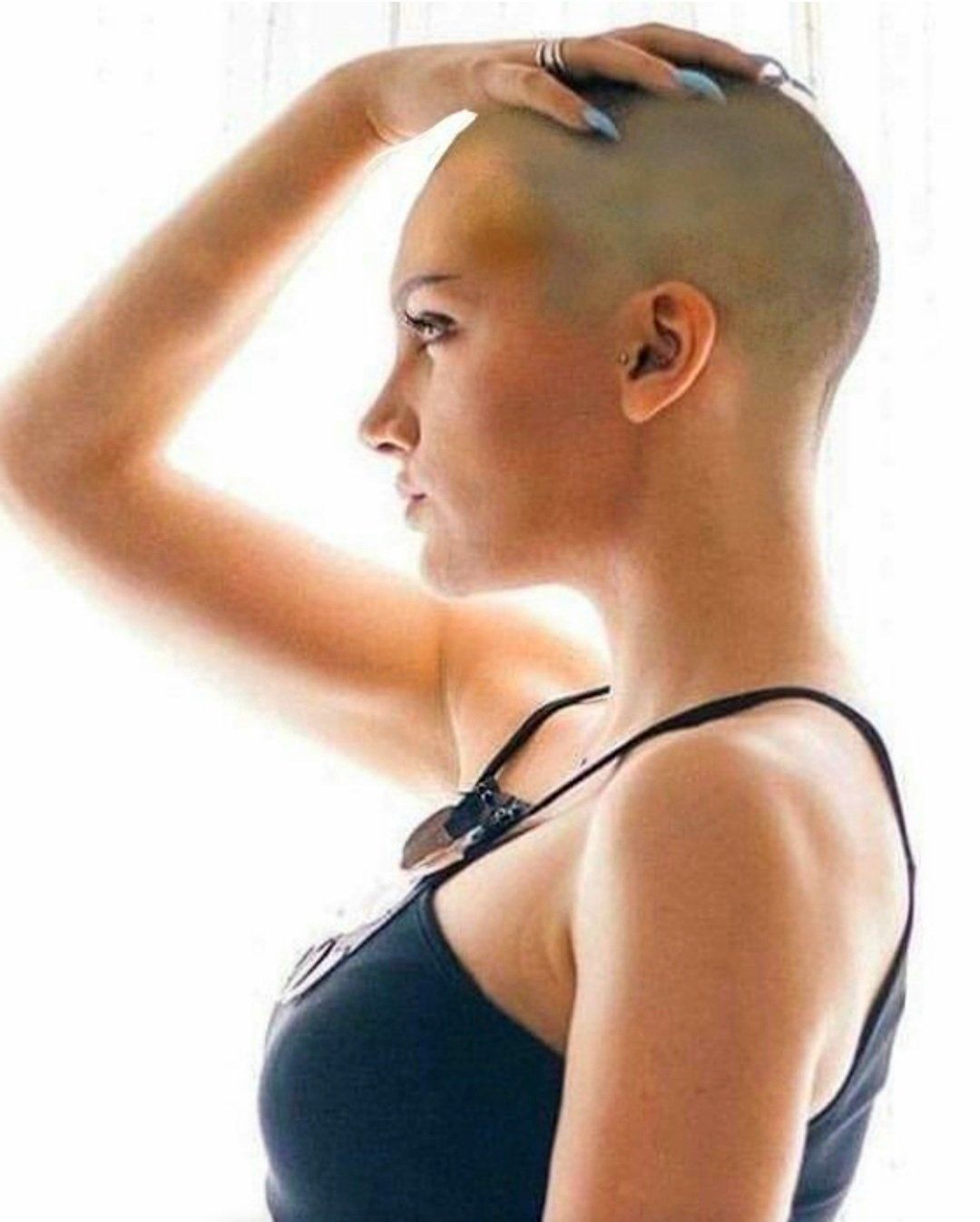 Cancer et impact sur les cheveux