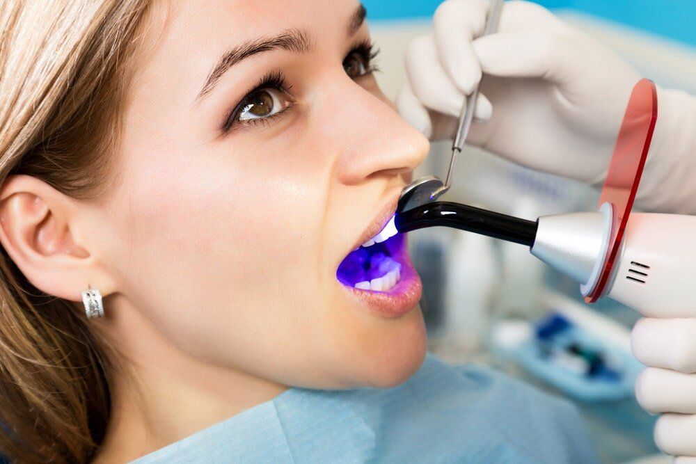 Teeth Fillings — Bytes Of Byron Eco Dentistry in Byron Bay, NSW
