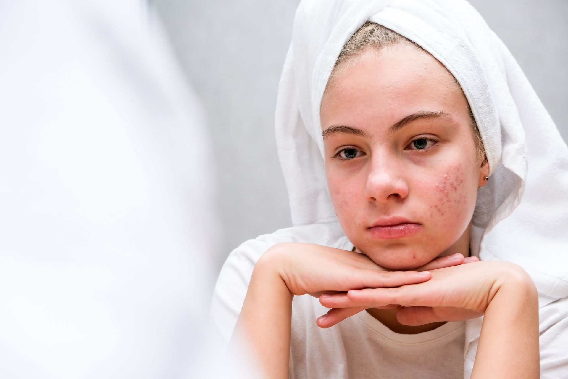 A young woman with a towel wrapped around her head is looking at her face in the mirror.