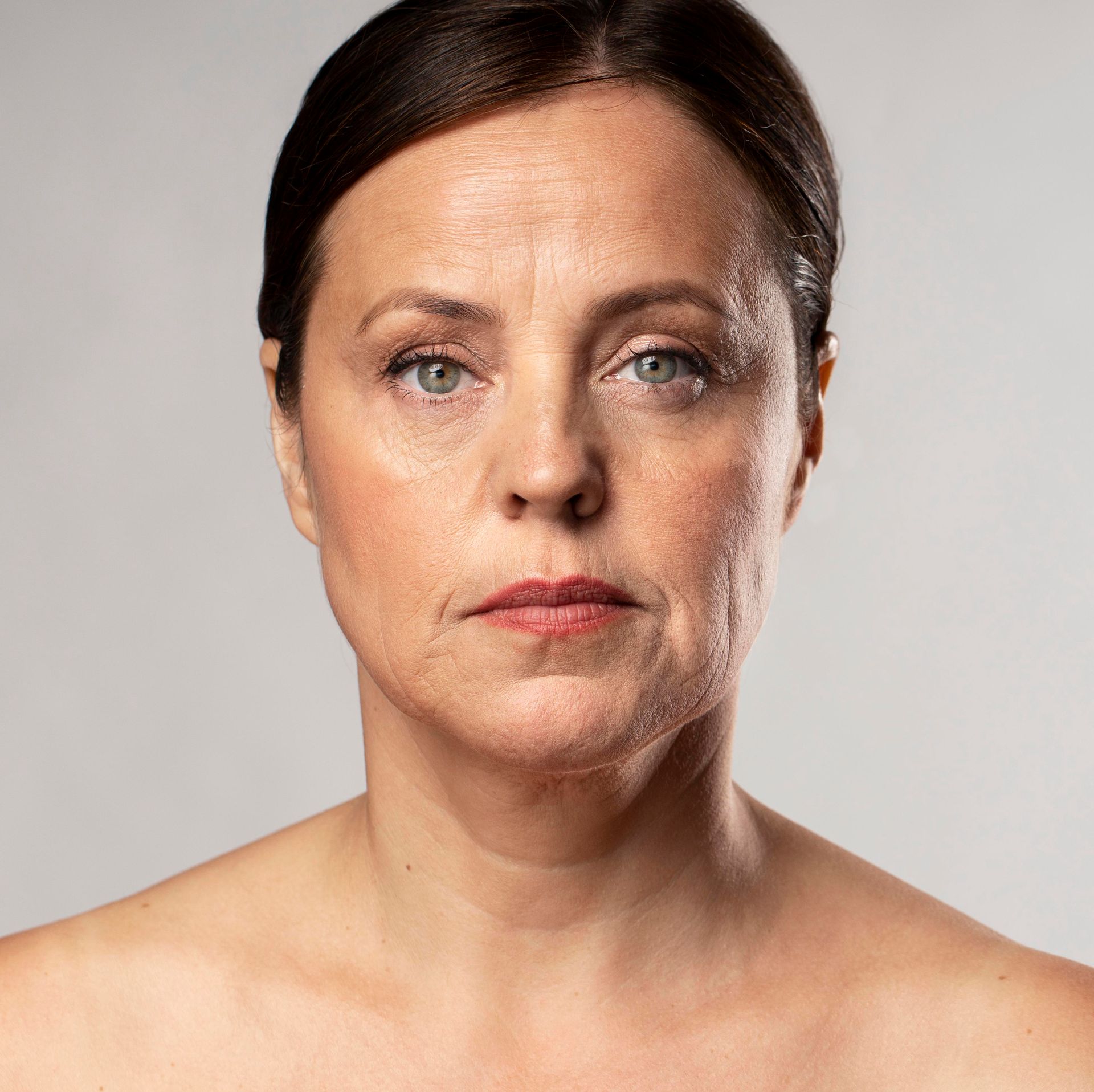 Woman with fair skin, looking forward, showing wrinkles on face and neck.