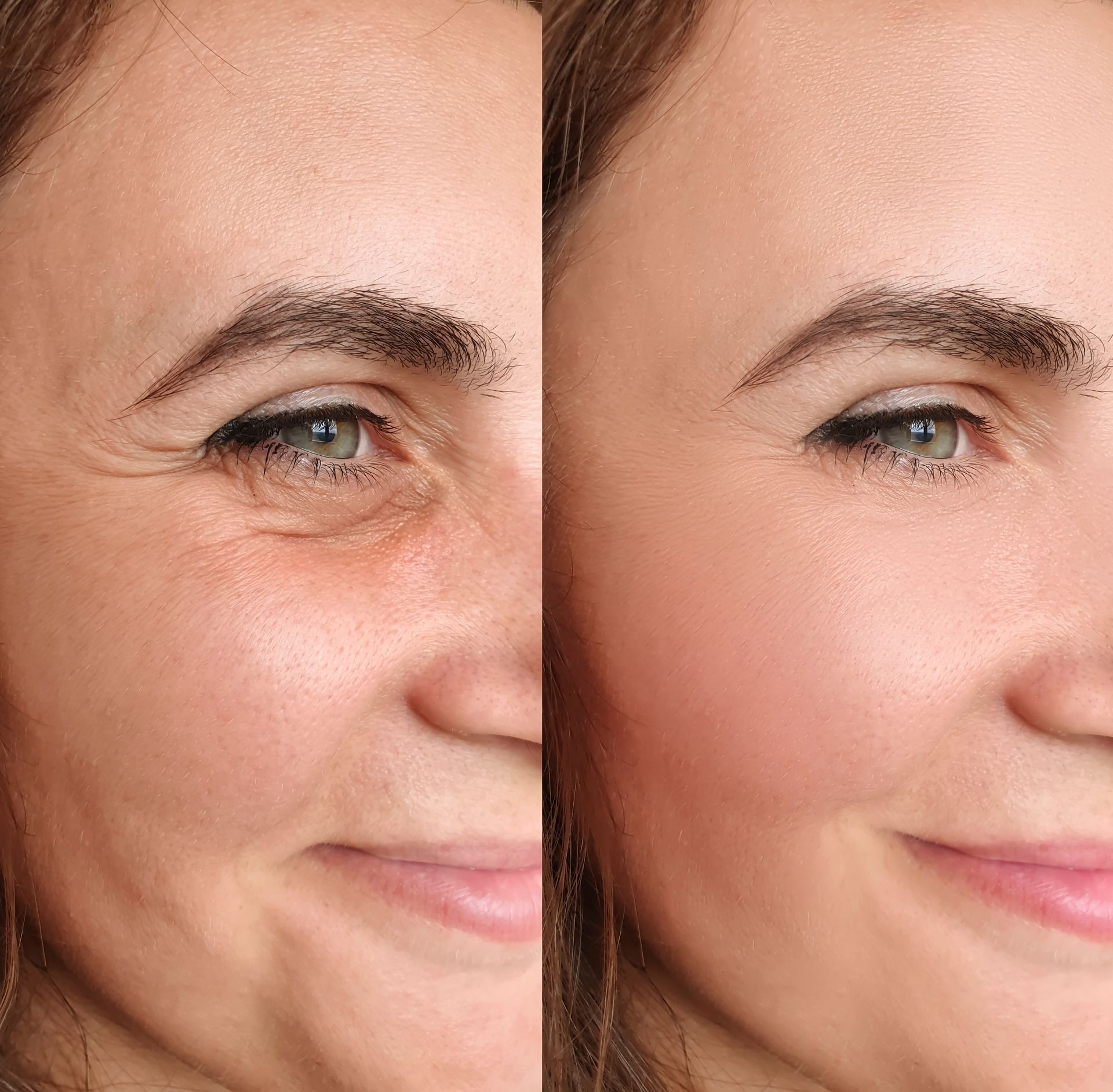 A before and after photo of a woman 's face.